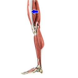 Picture of Iliotibial Band Syndrome