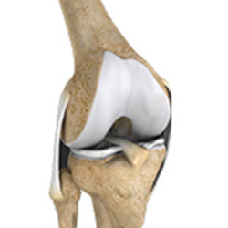 Picture of Multiligament Instability