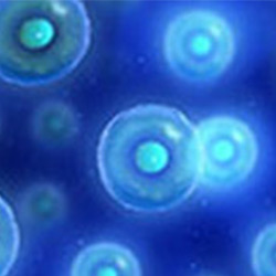 Picture of Sprains and Strains