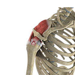 Picture of Partial Rotator Cuff Tear