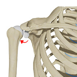 Picture of Posterior Shoulder Instability