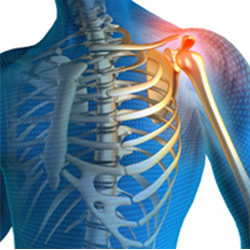 Picture of Shoulder Pain