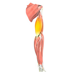 Picture of Triceps Tendonitis