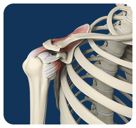 Picture of Rotator Cuff Repair Icon