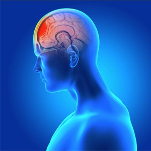 Picture of Sports Concussion