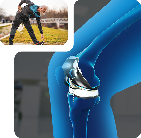 Minimally Invasive Img