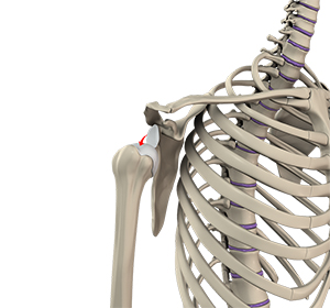 Shoulder Instability Image