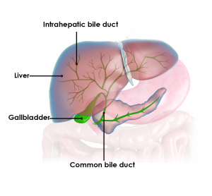 Biliary Tract Cancer pic