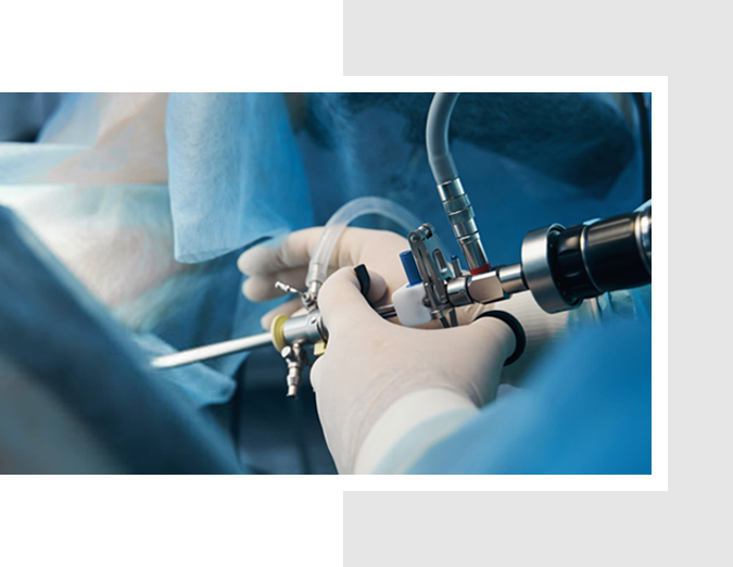 Arthroscopic
Surgery