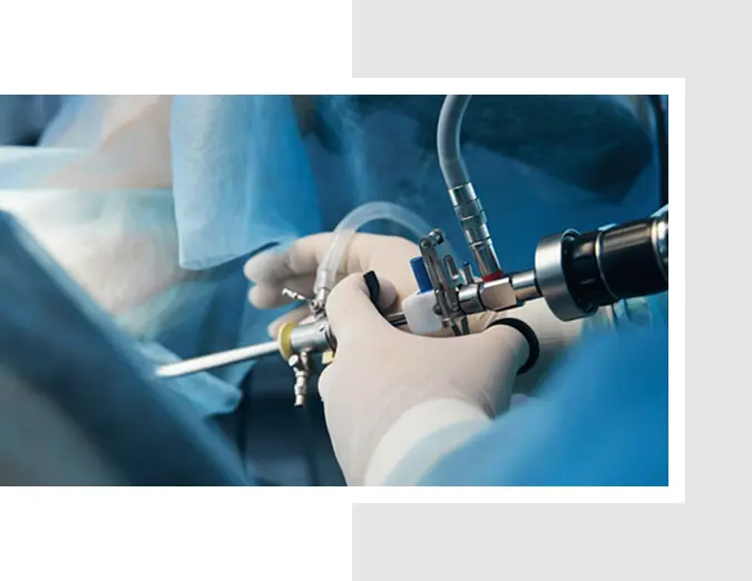 Arthroscopic Surgery