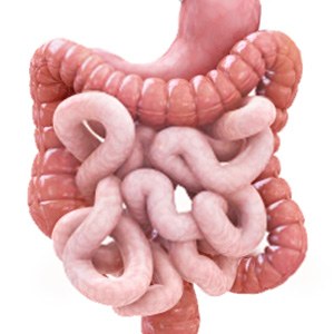 Picture of Laparoscopic Adjustable Gastric Banding