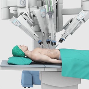 Picture of Robotic Surgery