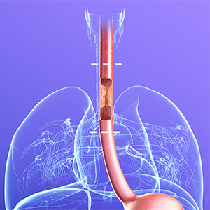 Picture of Stomach and Upper GI Surgery