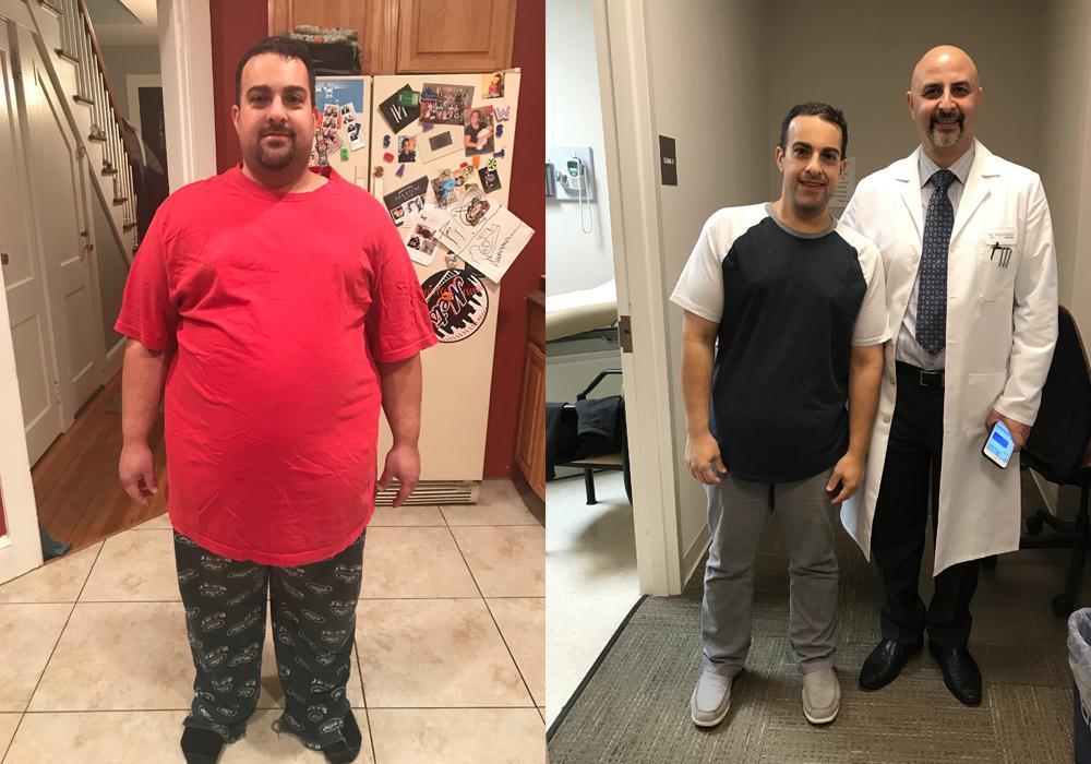 Weight Loss Before And After Picture 1