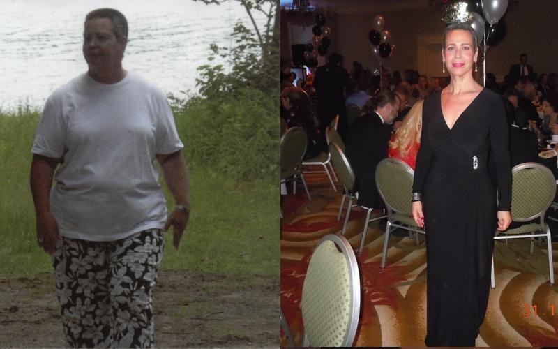 Weight Loss Before And After Picture 2