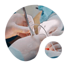 General Surgery Small Picture