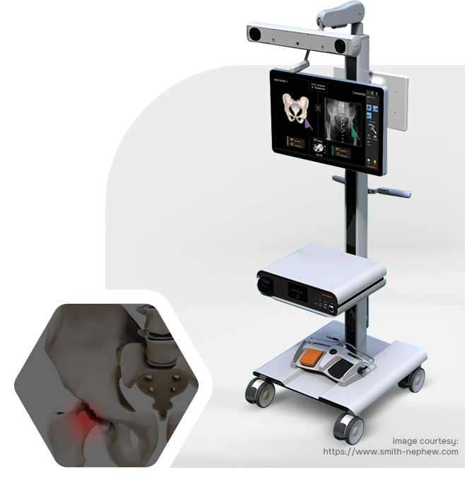 CORITM Surgical System