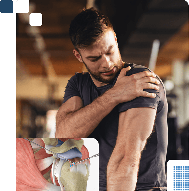 Rotator Cuff Repair Img