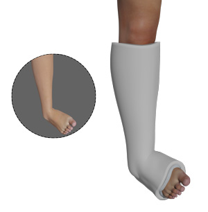 Clubfoot Casting and Surgery pic