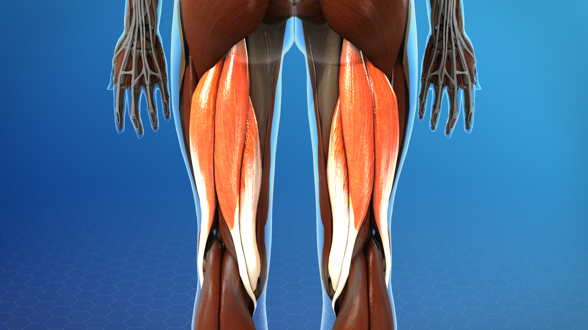 Picture of Proximal Hamstring Tear