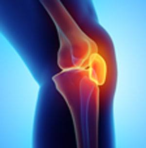 Knee Pain pic