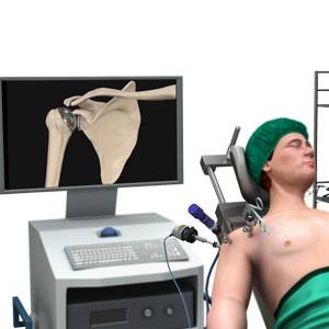 Shoulder Surgery pic