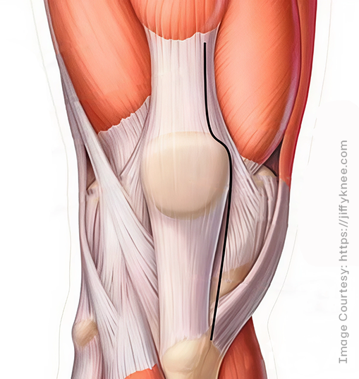 Innovative Technique Img