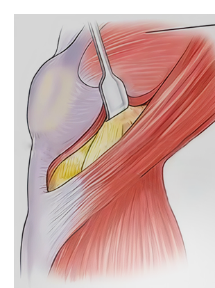 Jiffy Knee Surgeons Img