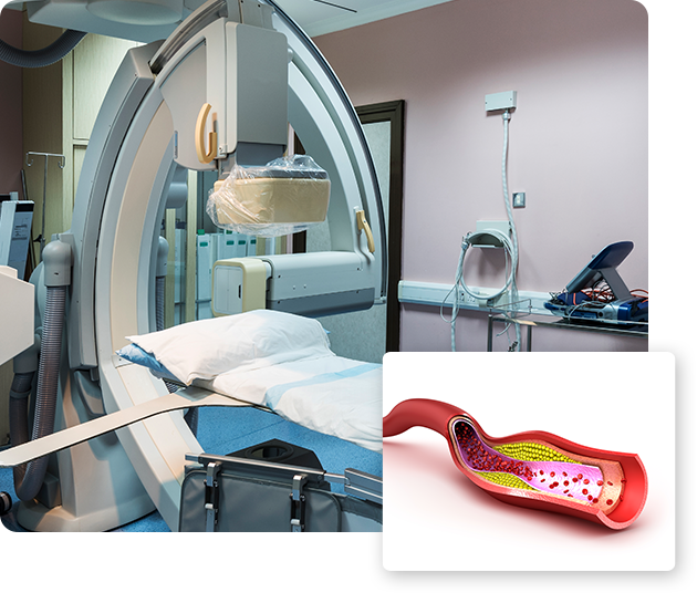 Endovascular Surgery - minimally invasive technique