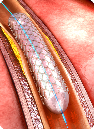 Procedures Performed