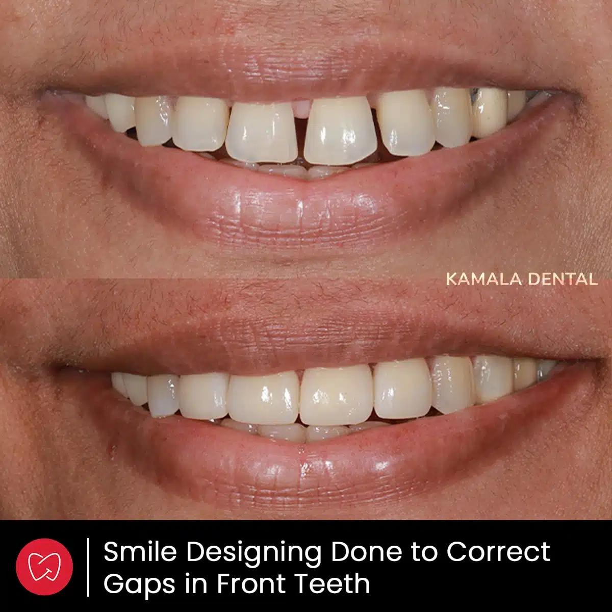 Kamala Dental Clinic Tour