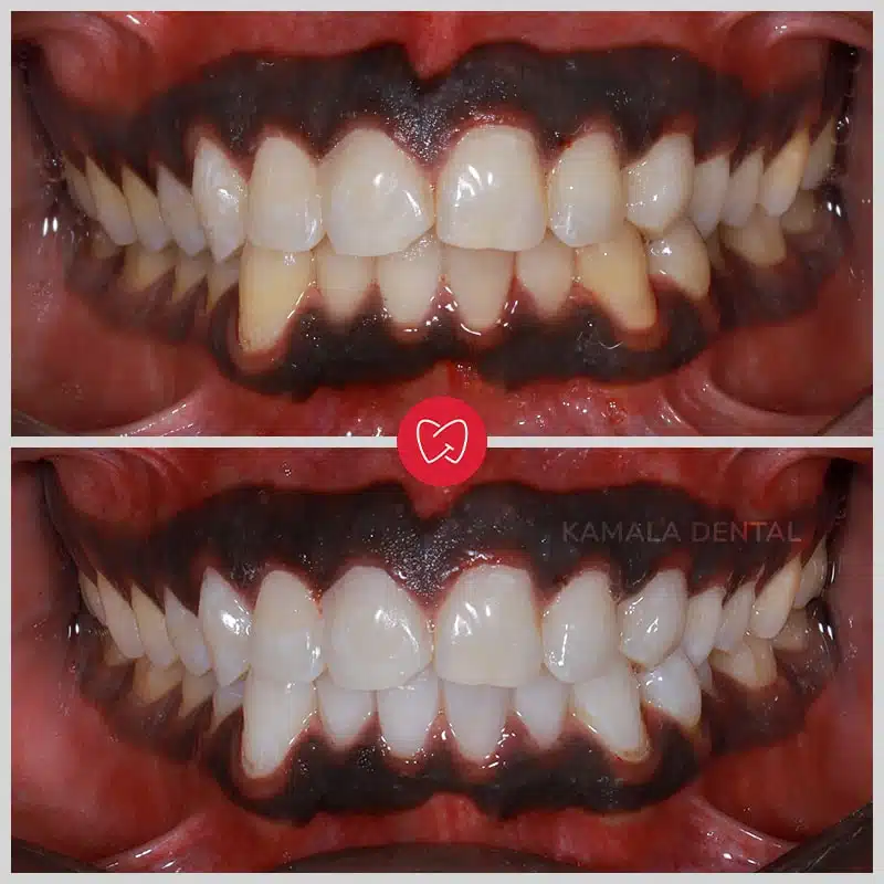 Kamala Dental Clinic Tour