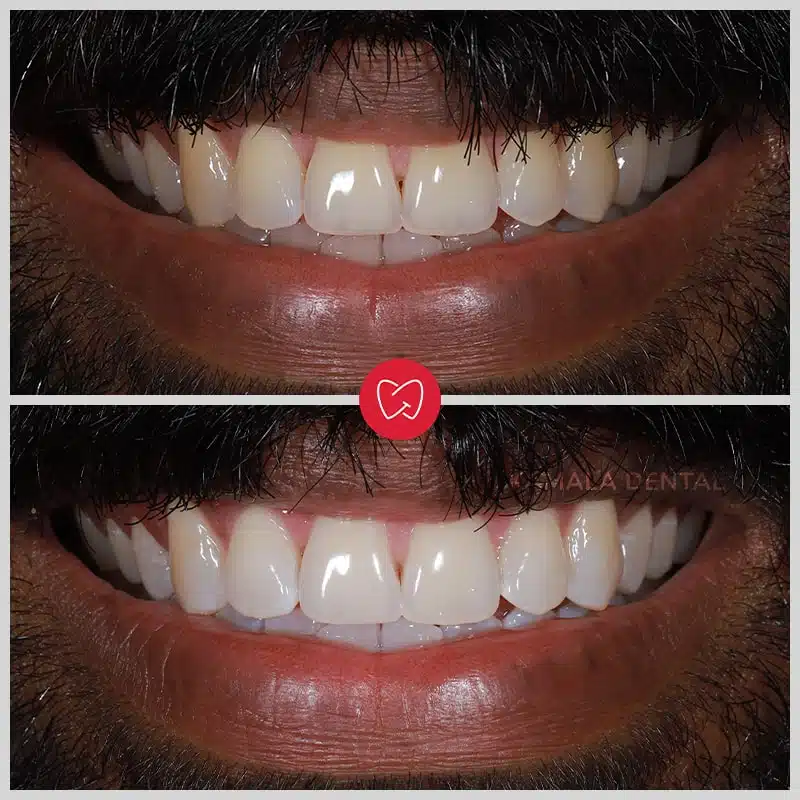 Kamala Dental Clinic Tour