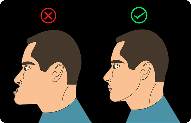 Corrective Jaw Surgery