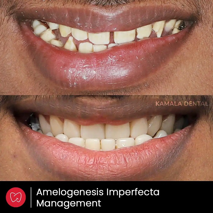 Kamala Dental Clinic Tour