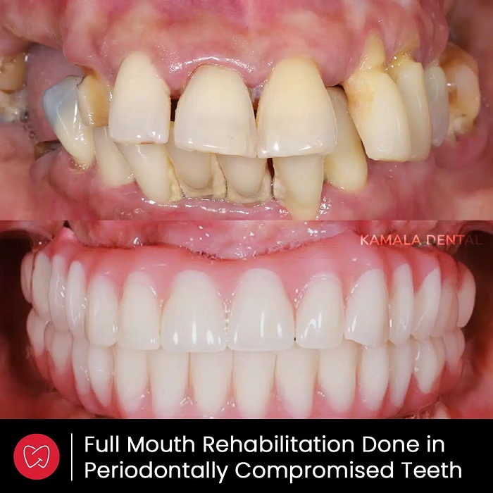 Kamala Dental Clinic Tour