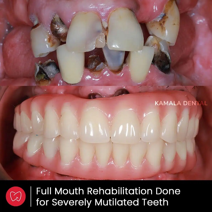 Kamala Dental Clinic Tour