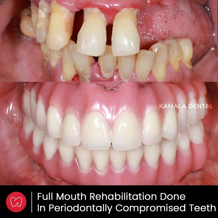 Kamala Dental Clinic Tour