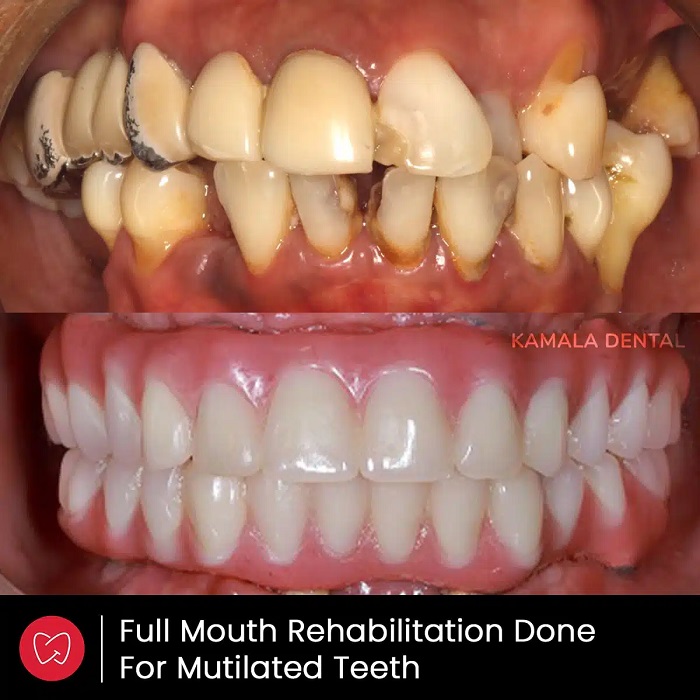 Kamala Dental Clinic Tour