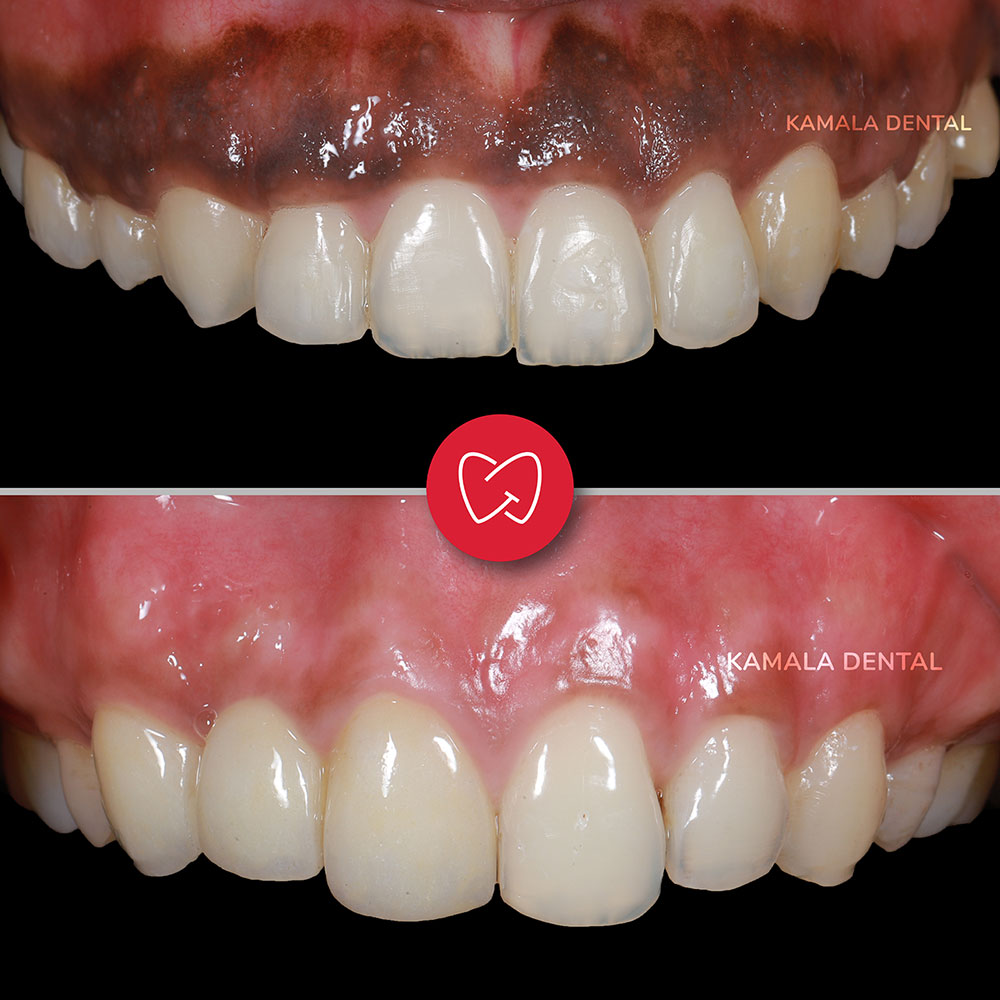 Kamala Dental Clinic Tour