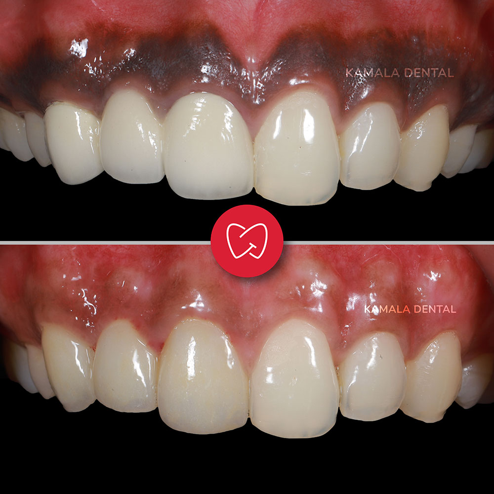 Kamala Dental Clinic Tour