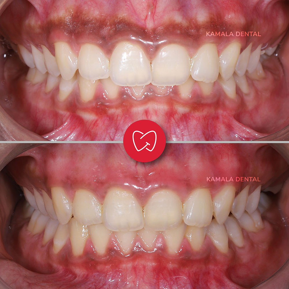 Kamala Dental Clinic Tour