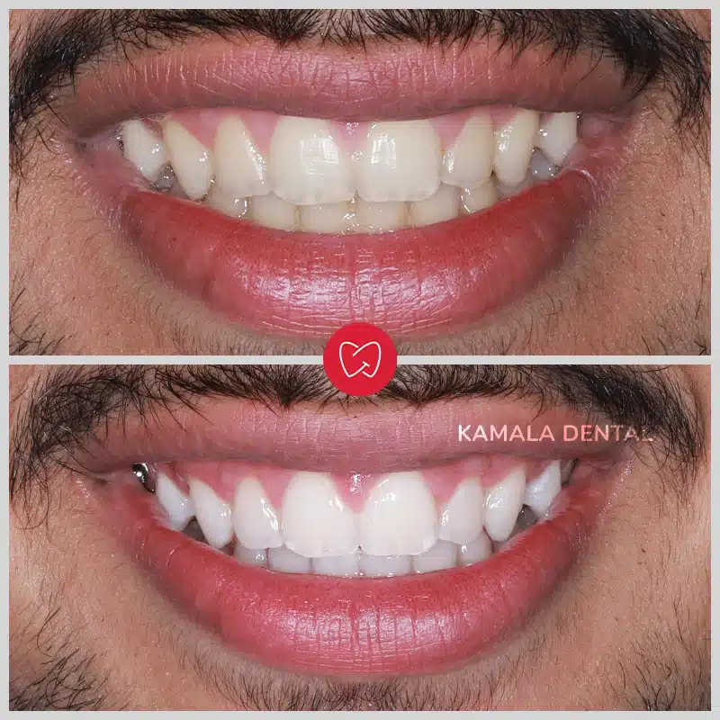 Kamala Dental Clinic Tour