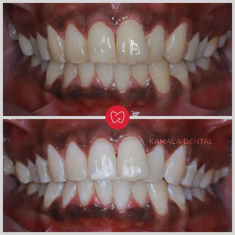 Kamala Dental Clinic Tour