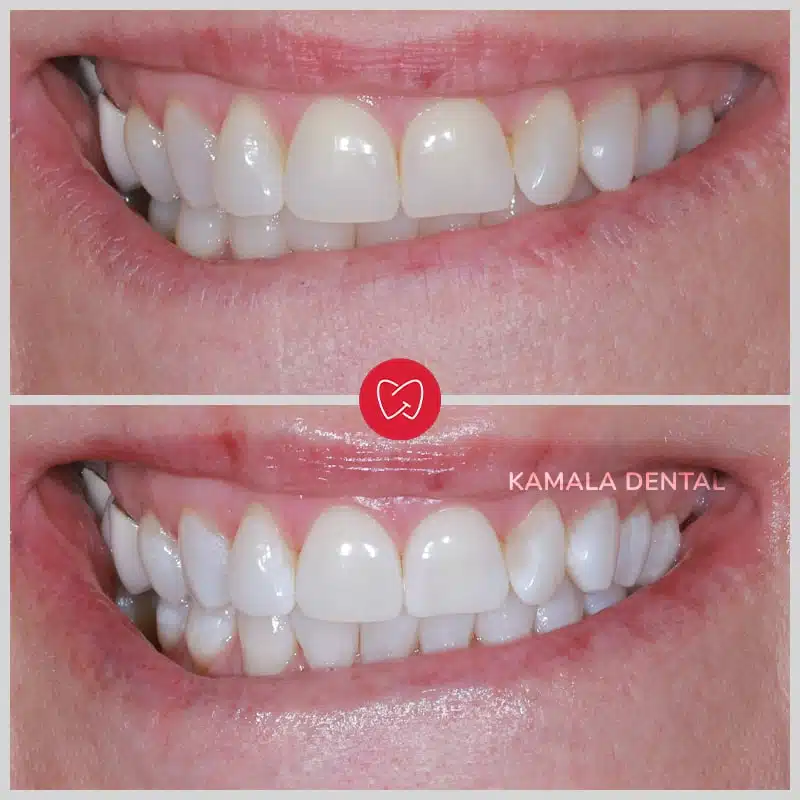 Kamala Dental Clinic Tour