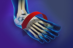 Ankle Instability Surgery Icon