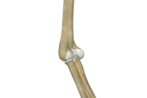Elbow Arthroscopy Icon