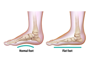 Flatfoot Icon