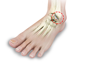 Foot and Ankle Arthritis Icon