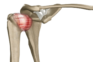 Frozen Shoulder Icon